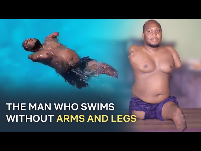 Man Without Arms And Legs Lives Life Without Limits: You Won't Believe His Story! class=