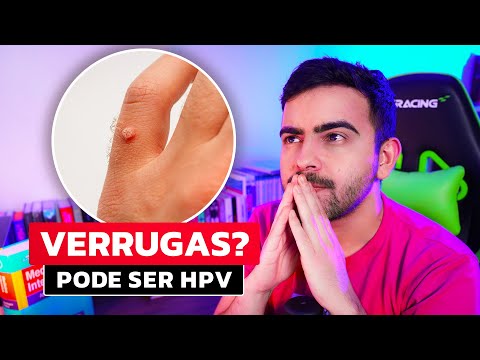 Sintomas do HPV │ Prevenção e Tratamento do PAPILOMA VIRUS HUMANO