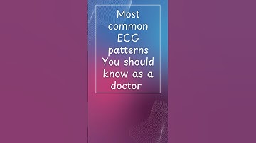 Most Common ECG patterns You Should Know #mrcp #fcps #cardiology #ecg #ecgs #ecginterpretation #ekg