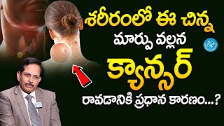 Dr Rama Mohan Reddy - శరీరంలో ఈ చిన్న మార్పు వల్లన క్యాన్సర్ రావడానికి ప్రధాన కారణం...? || iDream