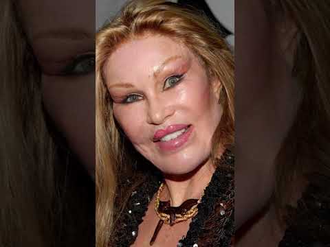Dr. O'Daniel facelift Reel
