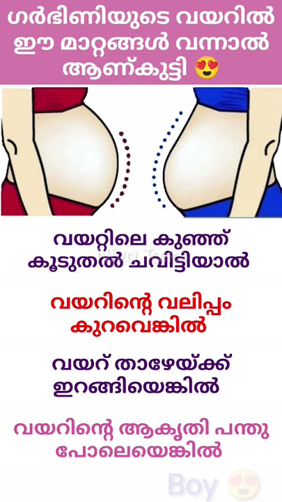 ഗർഭിണിയുടെ വയറിൽ ഈമാറ്റം ഉണ്ടെങ്കിൽ ആണ്കുട്ടി 💯#shorts #youtubeviral #trending#livevideo  #niyatalks