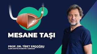 Mesane Taşı - Prof. Dr. Tibet Erdoğru