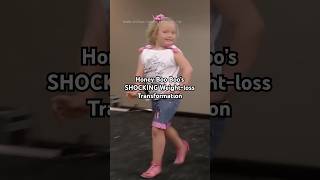 Honey Boo Boo & Mama June's Viral Weight Loss Transformation #honeybooboo #shorts #tlc