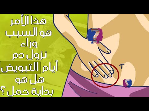 هل تعانين من نزول نقاط دم أيام التبويض هل يشير إلى حمل مبكر هذا الأمر هو السبب وراء ذلك