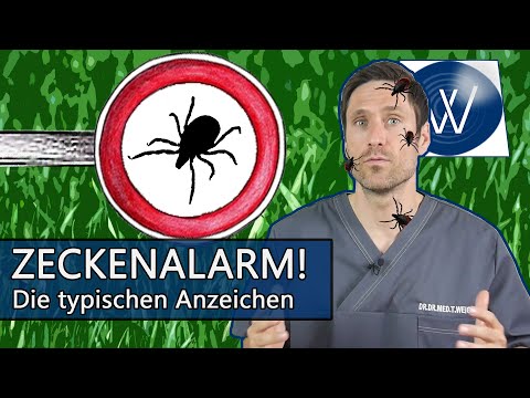 Video: Zeckenstich - Anzeichen Und Symptome Eines Zeckenstichs Beim Menschen, Folgen Und Erste Hilfe. Wie Sieht Ein Zeckenstich Aus?