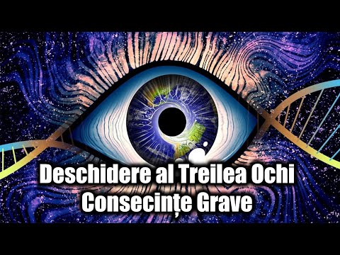 Video: Persoana A Avut Un Al Treilea Ochi? - Vedere Alternativă