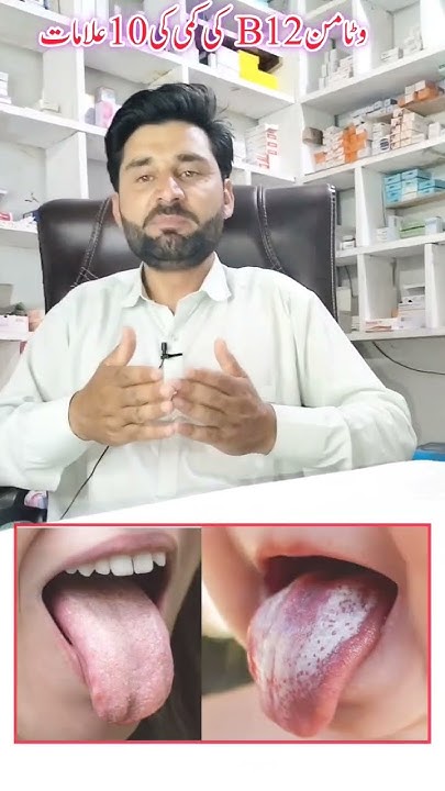 vitamin-b12-ke-kami-ke-alamat-10-symptoms-of-vitamin-b12-deficiency