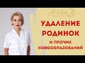 УДАЛЕНИЕ РОДИНОК | Как проходит удаление новообразований?