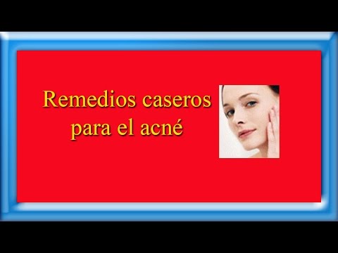 Remedios caseros para el acne