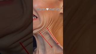 Nefertiti Neck Lift Visual - our favourite treatment!!