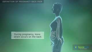 Pregnancy back pain Definition