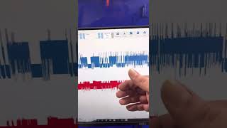 16 Ram 1500 CAN bus failure due connection issue at network comb (star connector) part 1