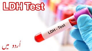 LDH Test in urdu | lactate dehydrogenase (LDH) test? | LDH kiya hota hai | LDH test kyun kiya jata h