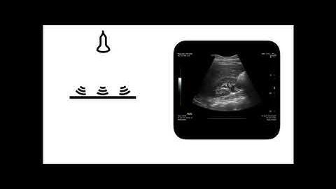 1  EMET   Introduction to ultrasound
