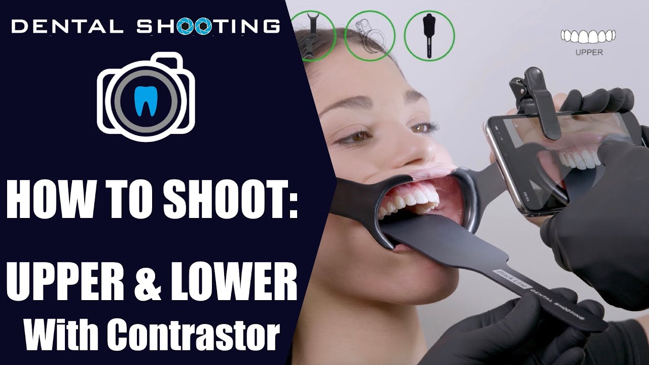 HOW TO SHOOT UPPER & LOWER WITH CONTRASTOR (Dental Shooting) YouTube