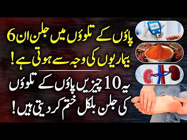 Burn Sensation In Foot Causes, Symptoms and Treatment Urdu Hindi - Paon Ky Talway Jalnay Ka ilaj class=