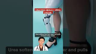 Cracked Heels Won't Heal? Try Urea Foot Cream