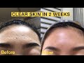 How I transformed my skin's texture within 2 weeks!⎪My Daytime and Nighttime skincare routine
