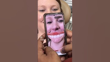 Chairside Shade Guide 8.0 App