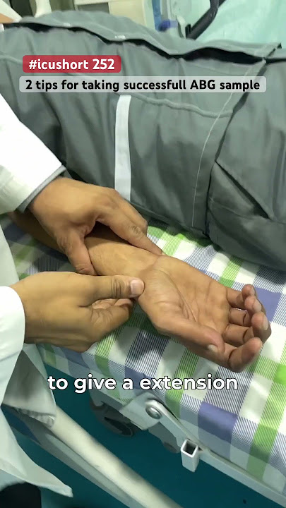 #icushort 252: How to properly  position hand for taking ABG sample #esbicm #shorts