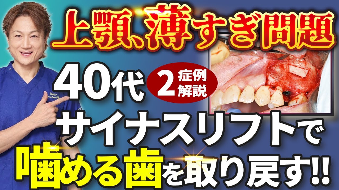 Must see for those who have been turned down by other clinics