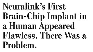 Neuralink will need to be removed from the first human