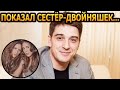 НЕ ТАКИЕ УСПЕШНЫЕ, КАК БРАТ! Как живут и выглядят сестры-двойняшки - Станислава Бондаренко?