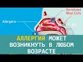Аллергия может возникнуть в любом возрасте | ECONET.RU