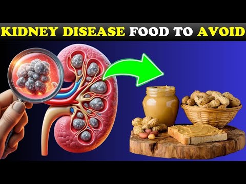 ⚠️ STAY AWAY From These 15 Foods You Have KIDNEY Disease! | Healthy Care