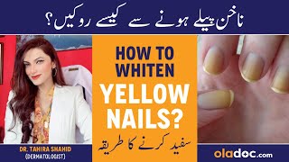 Yellow Nails Treatment Urdu - Care Hacks For Beautiful Pink Nails - Peele Nakhun Ko Saaf Kaise Kare