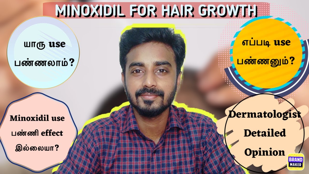 Minoxidil for Hair growth || யாரு use பண்ணலாம்? எப்படி use பண்ணனும்? Detailed video || DermaTalks