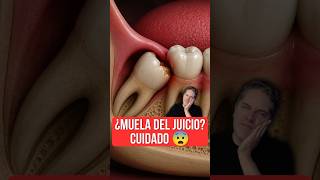 ¿Qué pasa si NO te quitas las muelas del juicio? - Doctores Especialistas