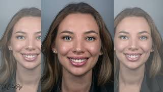 FIXLITE-PORTRAIT -THE BEST CHAIR-SIDE PORTRAIT PHOTOGRAPHY SOLUTION, IDEAL FOR SMALL DENTAL OFFICES