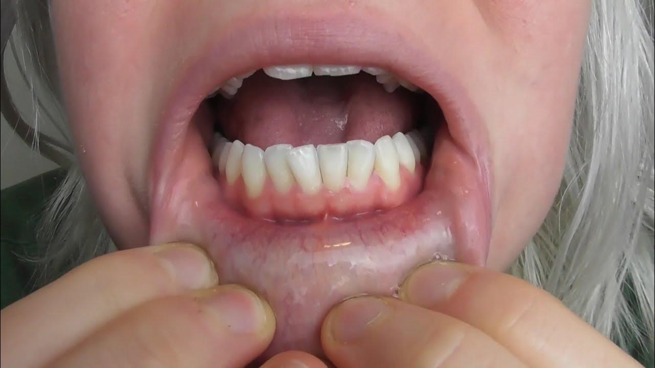 Mouth Tour And Uvula Close Up Youtube