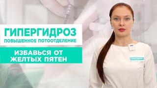 ГИПЕРГИДРОЗ: Как вылечить повышенное потоотделение?