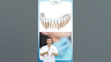 Răng Khấp Khểnh Niềng Invisalign Được Không ? | Bác Sĩ Yên