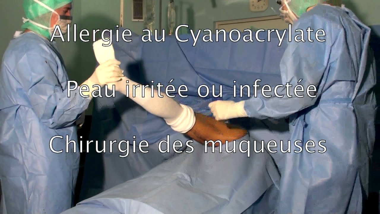 Integuseal en Pratique en Français. - YouTube