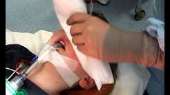 Strabismus surgery, Preping & draping- P 1/56