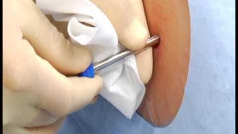 MED Essentials of Spirotome Procedure in Muscle Biopsies 07112011