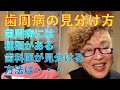 歯周病の見分け方(咬合外性傷とは)