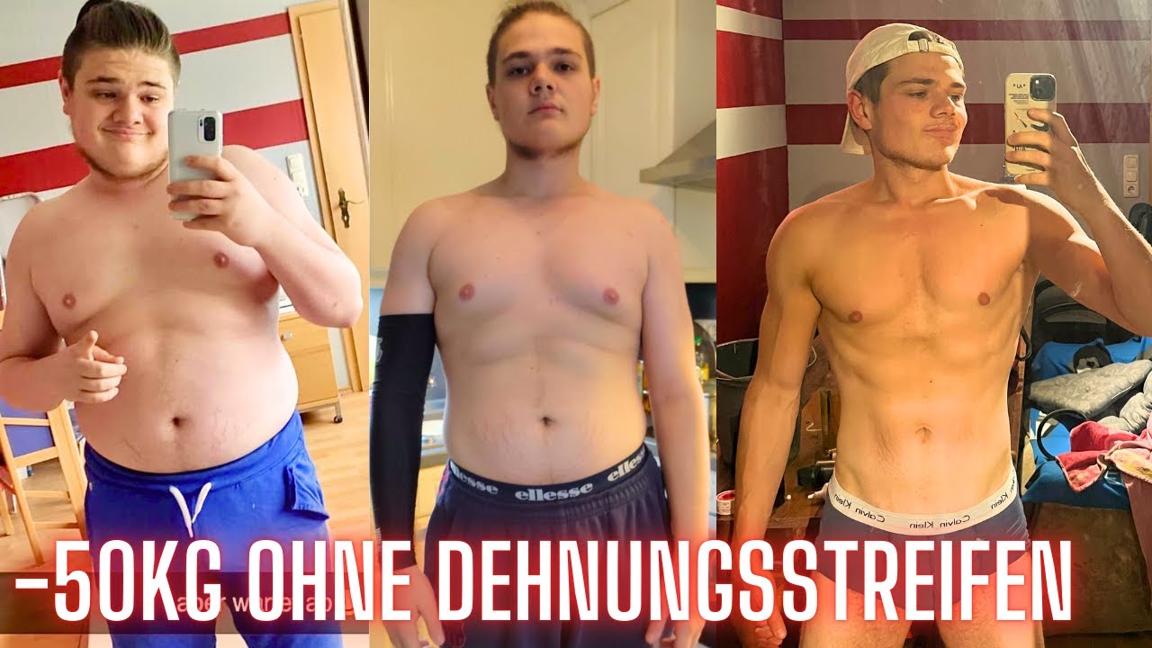 Verwunderlich 30 Kg Abnehmen Ohne Hautlappen Ebenbild