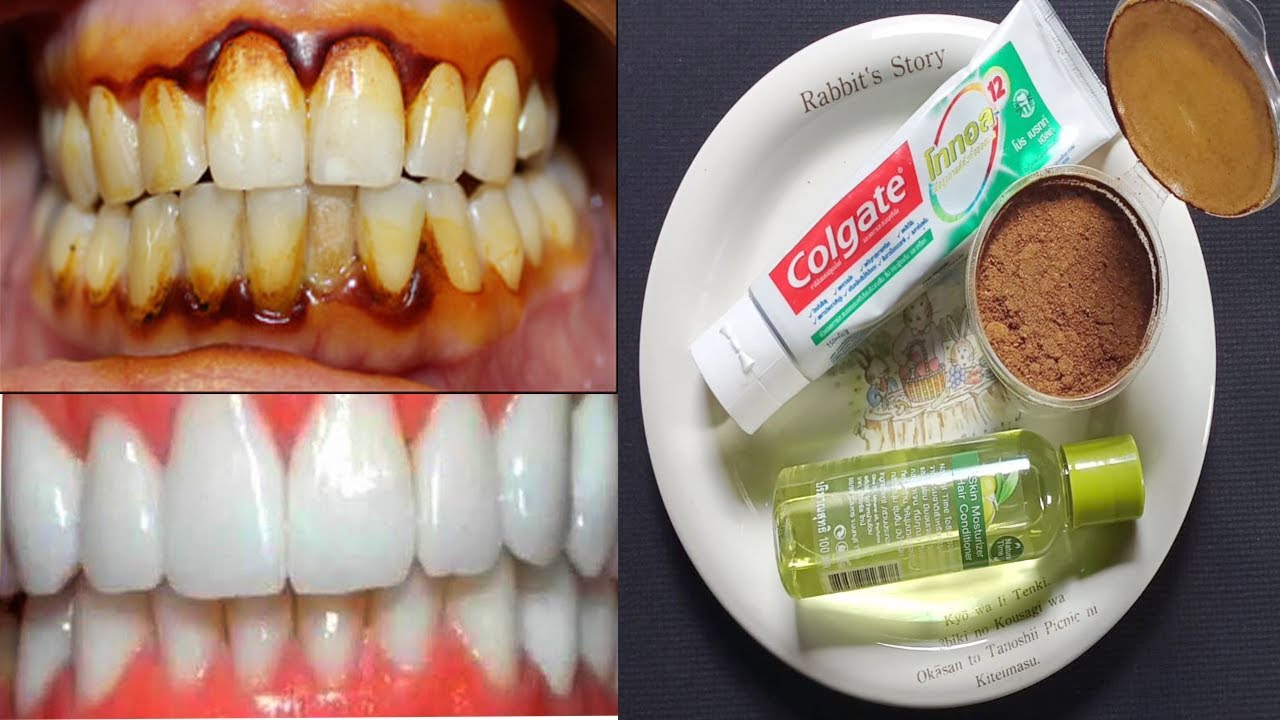 ホワイトニング Easy way to clean your teeth using olive oil and Colgate YouTube