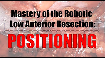 Robotic Low Anterior Resection Patient Positioning and Room Setup