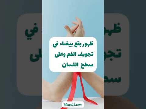 الأعراض المبكرة للإصابة بالإيدز