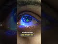 Pen Hit Over Eye | Dr. Kartik Gupta | Corneal Wound | Appointment -8920090907