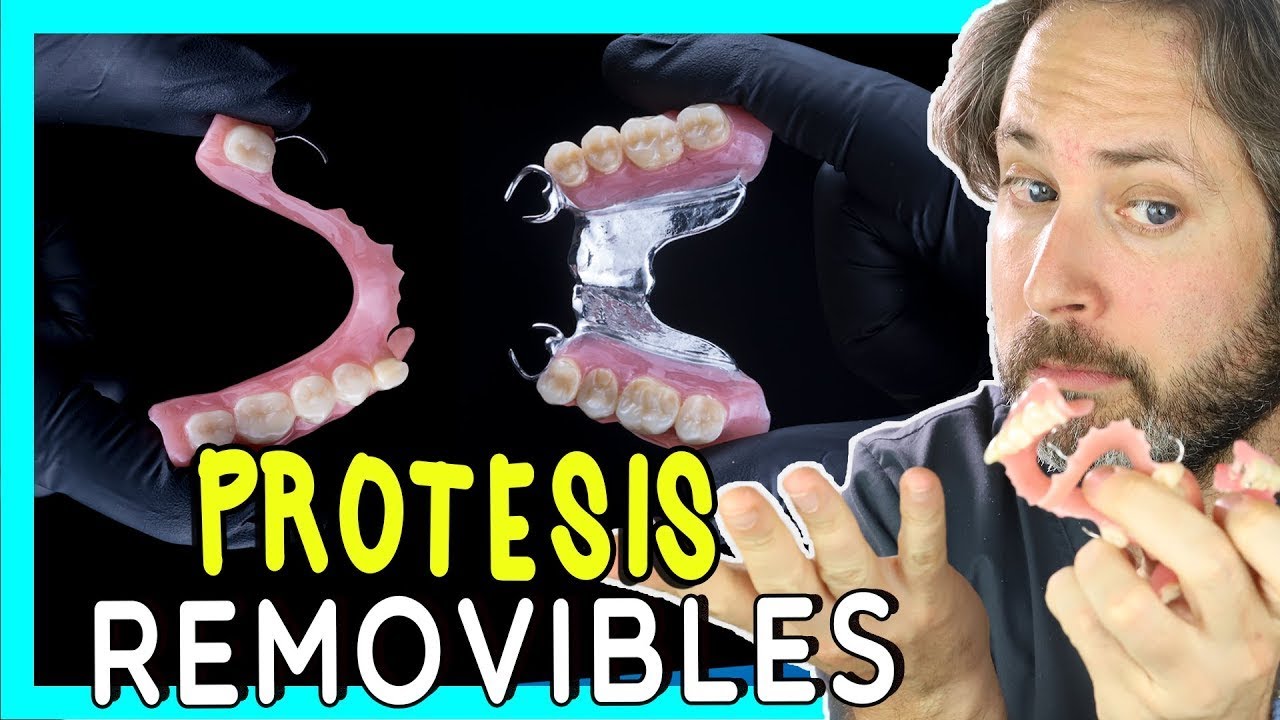 📍𝐓𝐈𝐏𝐎𝐒 𝐝𝐞 𝐏𝐑𝐎𝐓𝐄𝐒𝐈𝐒 𝐃𝐄𝐍𝐓𝐀𝐋𝐄𝐒 𝐑𝐄𝐌𝐎𝐕𝐈𝐁𝐋𝐄𝐒 para reponer DIENTES PERDIDOS TODAS las OPCIONES YouTube 📍𝐓𝐈𝐏𝐎𝐒 𝐝𝐞 𝐏𝐑𝐎𝐓𝐄𝐒𝐈𝐒 𝐃𝐄𝐍𝐓𝐀𝐋𝐄𝐒 𝐑𝐄𝐌𝐎𝐕𝐈𝐁𝐋𝐄𝐒 para reponer DIENTES PERDIDOS TODAS las OPCIONES YouTube