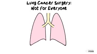 Radiation For Lung Cancer