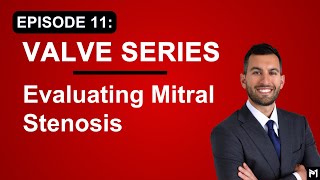 11. How to Evaluate Mitral Stenosis (MS) - TEE for Mitral Valve Surgery (Echocardiography)