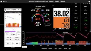Famous 🔬👨‍🔬  Estimation of Aerobic threshold (AeT) using DFA-alpha1 while monitoring Core body temperature. Profile